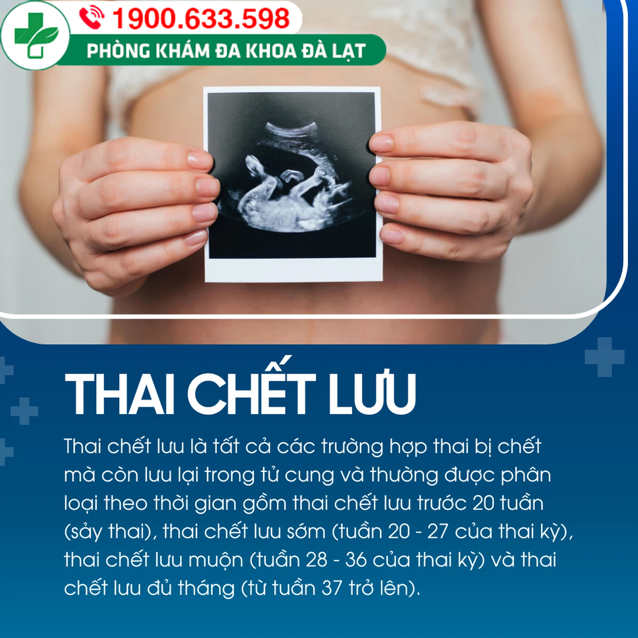 Hình ảnh minh họa